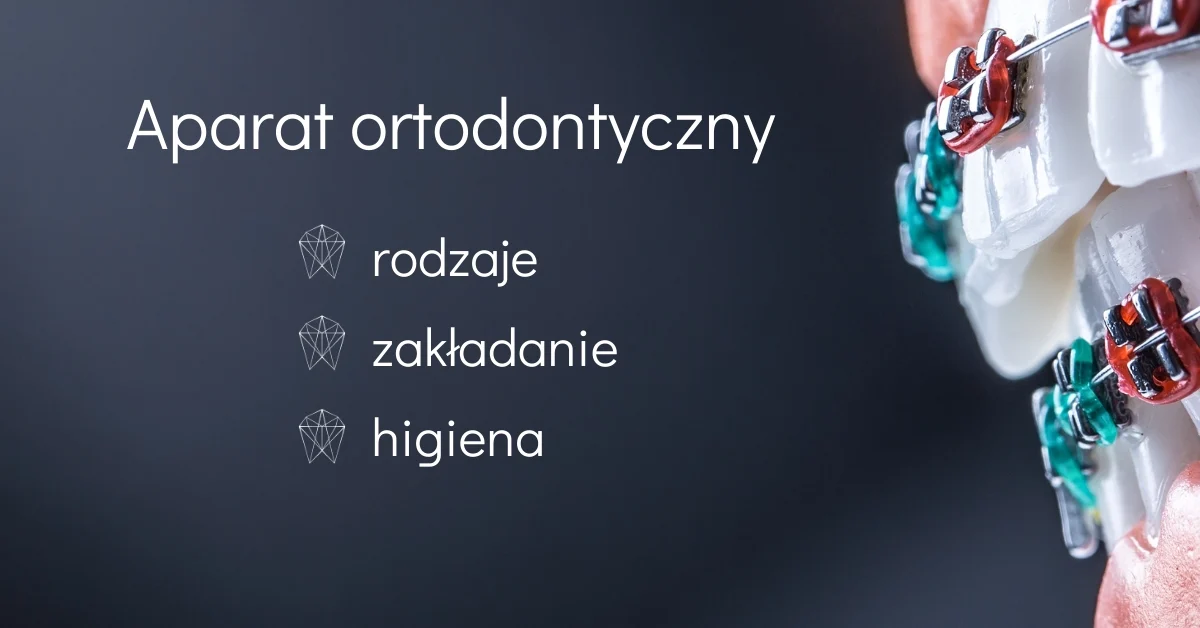 Aparat ortodontyczny