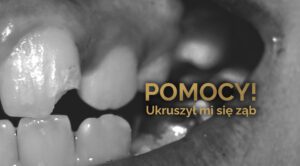 Ukruszony ząb