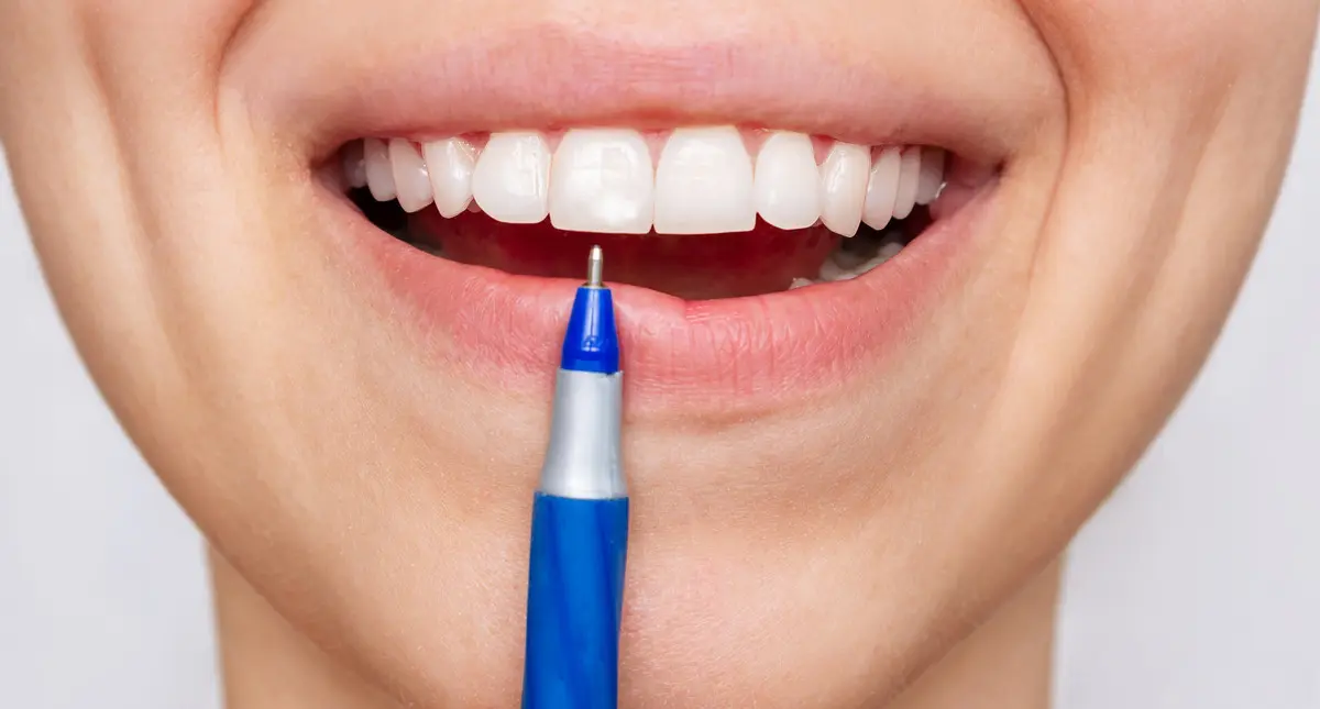 Nieestetyczne przebarwienia na zębach - leczenie stomatologiczne