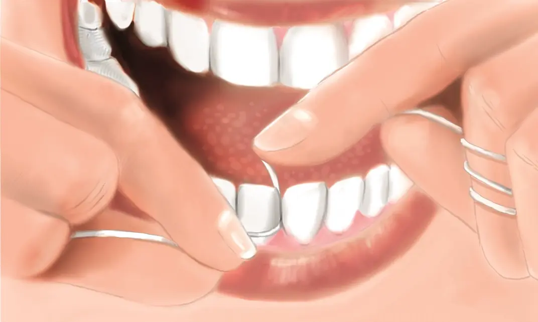 Przestrzeń międzyzębowa - wpływ na zdrowie jamy ustnej