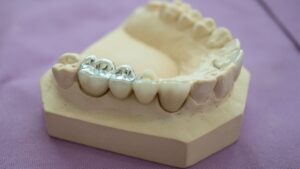 Estetyczne i trwałe wypełnienia kompozytowe