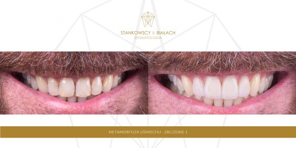 Metamorfoza - Rafał Bieniek Zblizenie